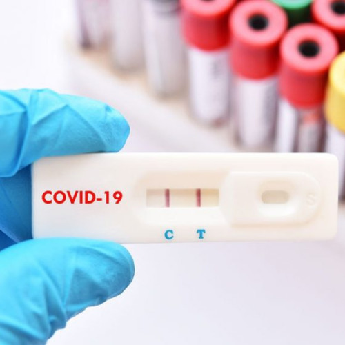 Testele rapide antigen, metoda oficială de diagnosticare a COVID-19