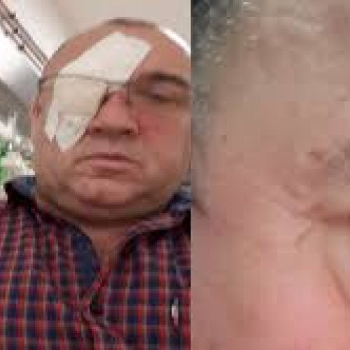 Legea privind agresiunea oculară, adoptată la Primăria Botoroaga